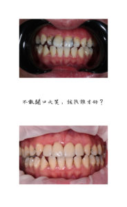 未命名 1 工作區域 1